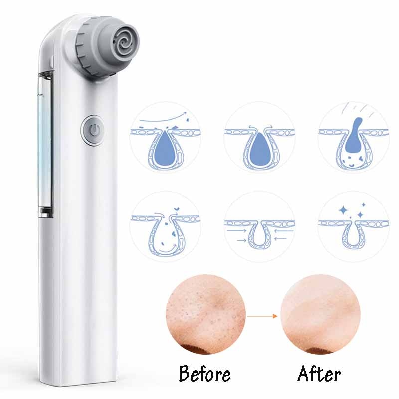 Blackhead Remover Vacuum Suction Acne Removal Deep Pore Cleansing Skin Beauty Care Tool Face Lifting Home Small Bubble Cleaner