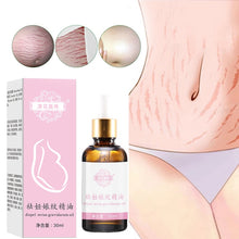 Load image into Gallery viewer, Stretch Marks Remover Essential Oil Skin Care Treatment Cream For Stretch Mark Removal Maternity Slackline For Pregnant Oils
