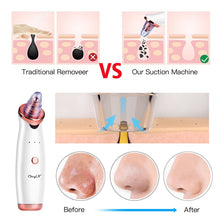 Load image into Gallery viewer, Blackhead Remover Skin Care Pore Vacuum Acne Pimple Removal Vacuum Suction Tool Facial Diamond Dermabrasion Machine Face Clean46
