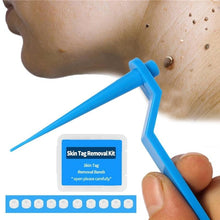 Load image into Gallery viewer, 1set Skin Tag Kill Skin Mole Wart Remover Micro Skin Tag Removal Kit With Cleansing Swabs Adult Mole Wart Face Care
