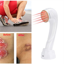 Load image into Gallery viewer, Arthritis Back Pain Neck Pain Infrared Laser Therapy Portable Cold Laser Machine Cervical Spondylopathy Treatment instrument
