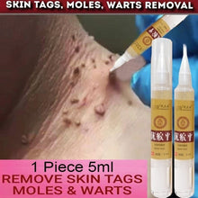 Load image into Gallery viewer, Skin Tag Remover Medical Against Moles 12 Hours Fast Removal Genital Wart Acne Spot Treatment Anti Foot Corn Skin Care Liquid
