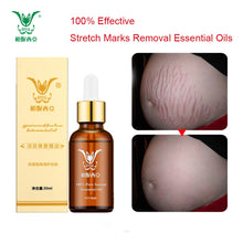 Load image into Gallery viewer, Stretch Marks Removal Essential Oils Pure Natural Stretch Marks Remover Obesity Postpartum Anti-wrinkle Repair Cream Skin Care
